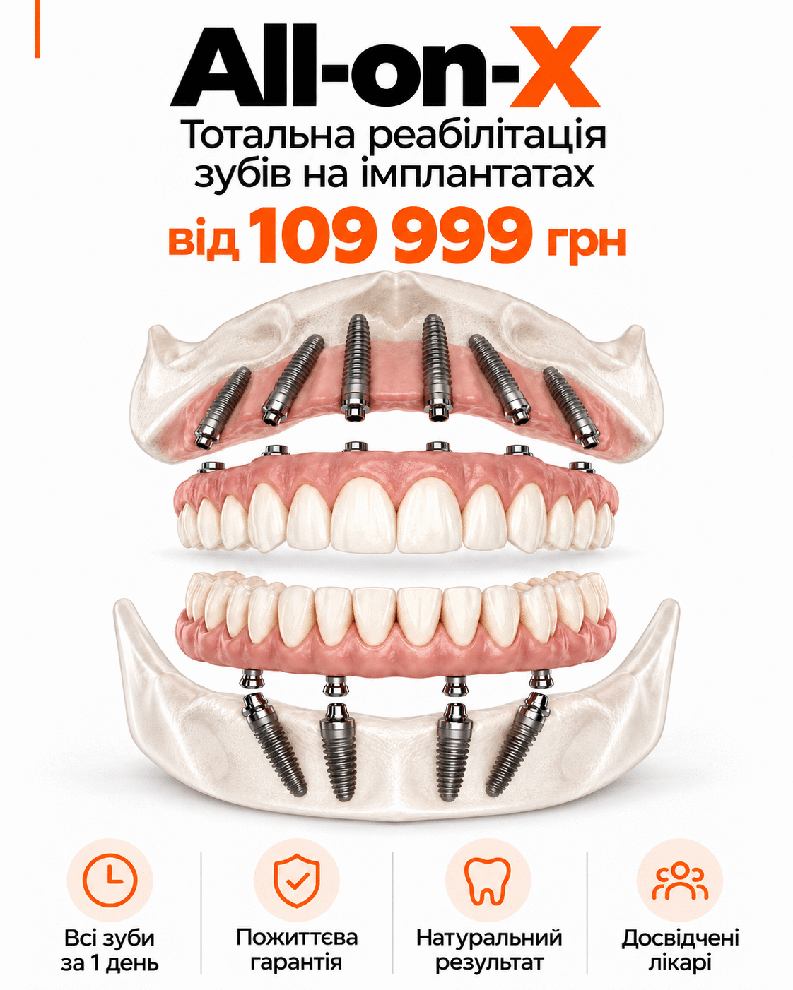 prosthesis